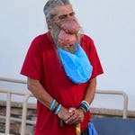 Image for episode "My Giant Nose Is Killing Me" from Health programme "Dr Pimple Popper"