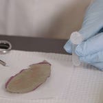 Image for episode "Within a Hair" from Scientific Documentary programme "Medical Detectives"