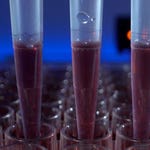 Image for episode "Bad Blood" from Scientific Documentary programme "Medical Detectives"